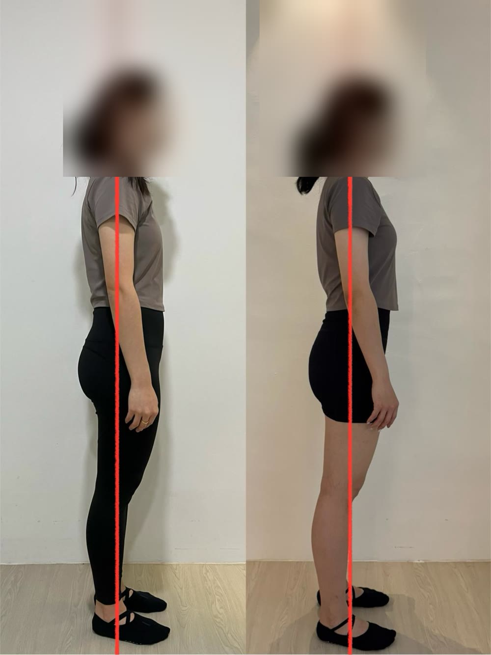 Client posture before and after — 1