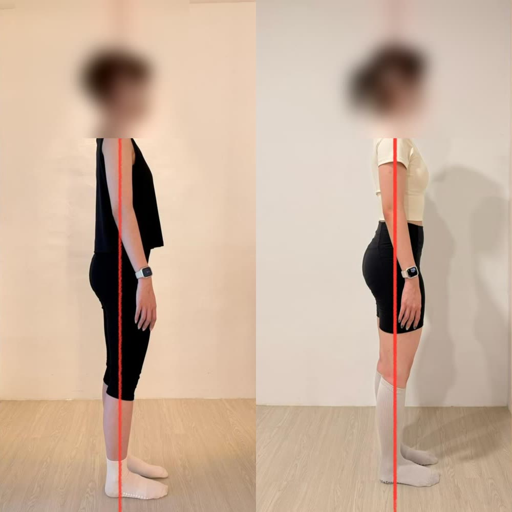 Client posture before and after — 2