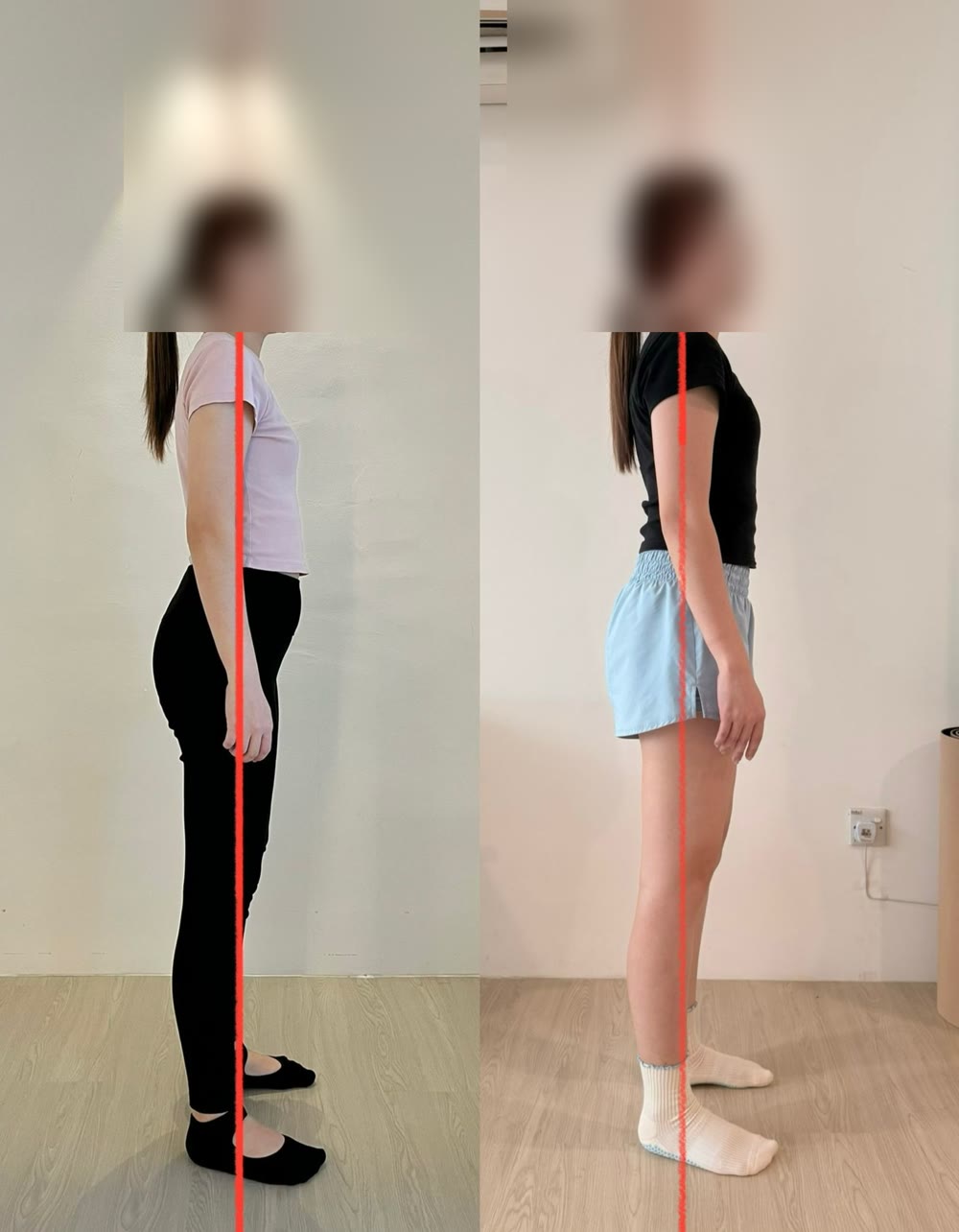 Client posture before and after — 3