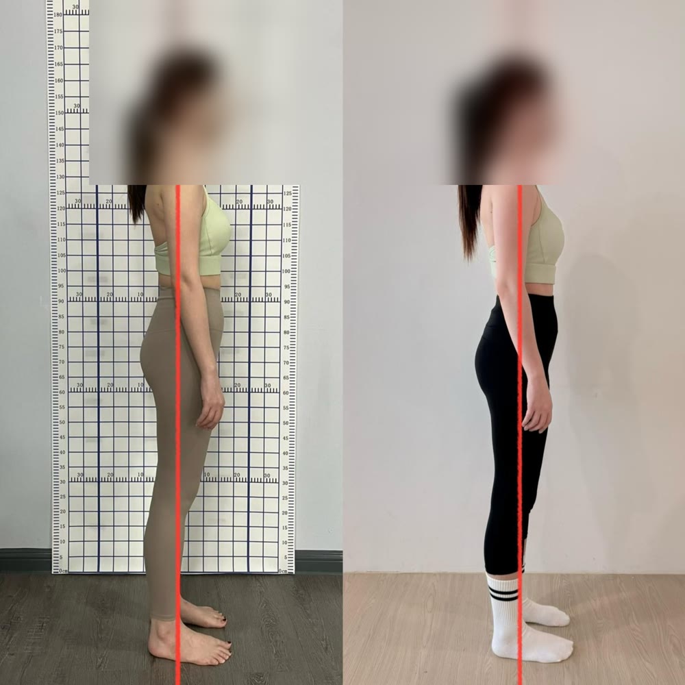 Client posture before and after — 4