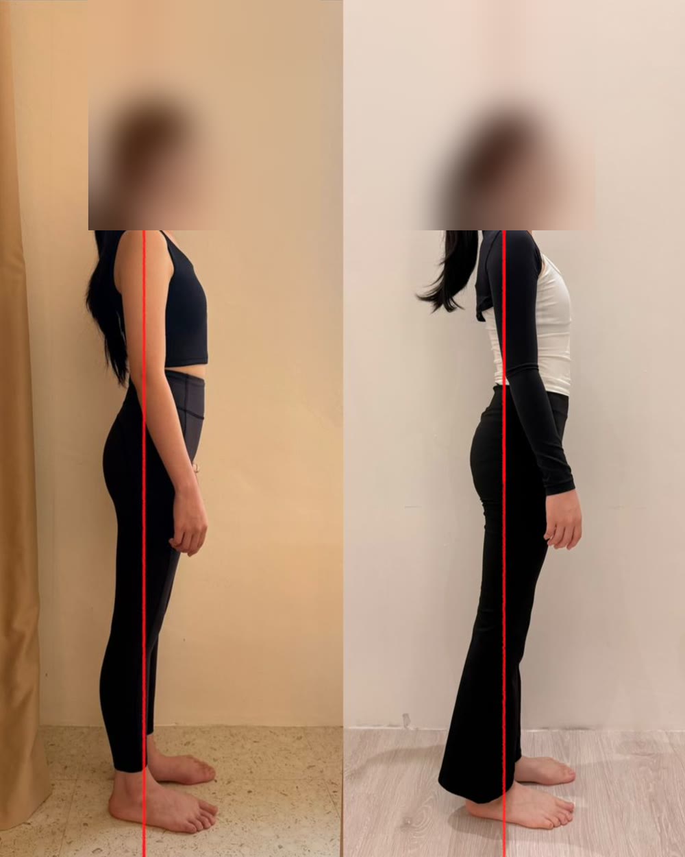 Client posture before and after — 5