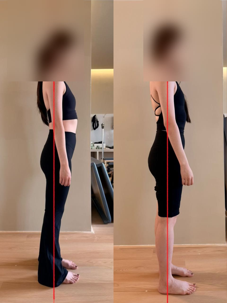 Client posture before and after — 6