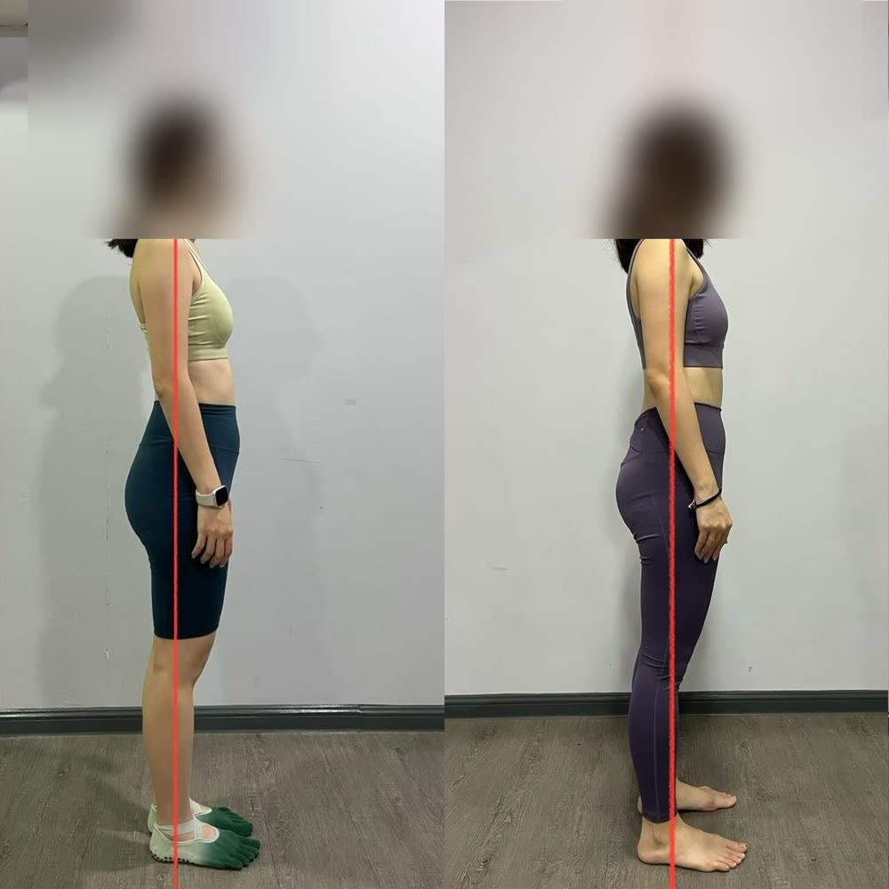 Client posture before and after — 7